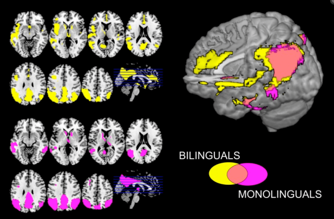 I cervelli bilingui combattono meglio i sintomi dell’Alzheimer